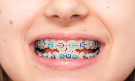 La ortodoncia infantil y la edad adecuada para iniciar un tratamiento