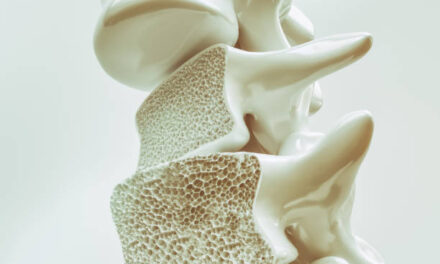 Revelador dato: uno de cada cinco hombres mayores de 50 años sufrirá una fractura osteoporótica en su vida