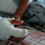 ¡Alarmante! Son 11 los lesionados por pólvora en Antioquia durante las primeras horas de diciembre