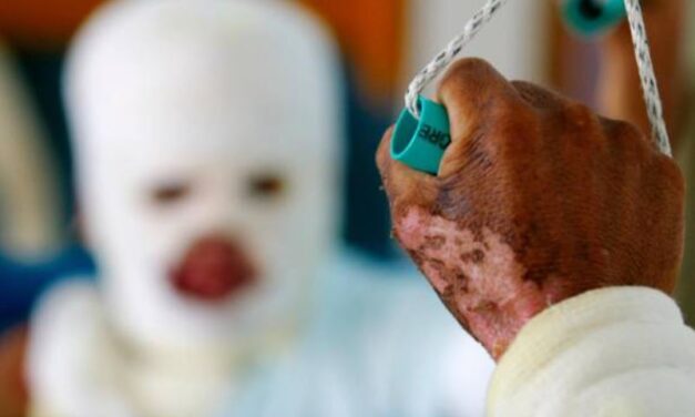 Antioquia reporta dos nuevos casos de lesionados por pólvora