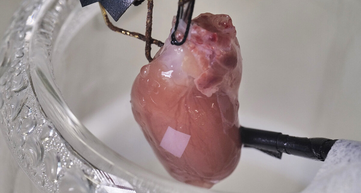 UPB patenta un parche cardiaco con funciones de marcapasos