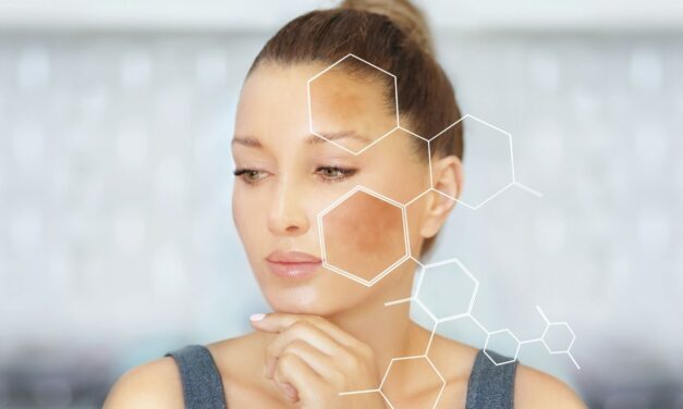 Tratamientos estéticos como desencadenantes del Melasma