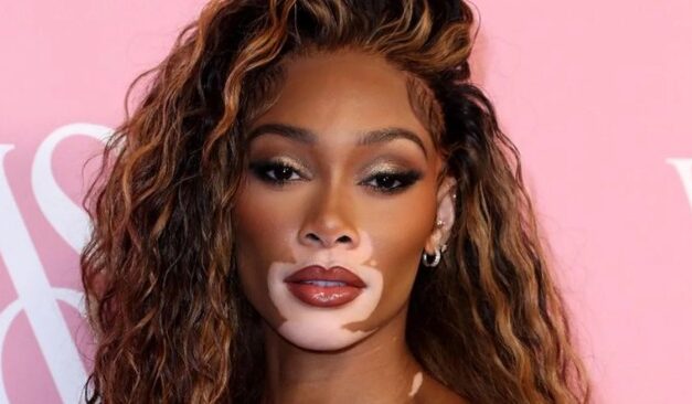 Concienciación y acción en el Día Mundial del Vitiligo