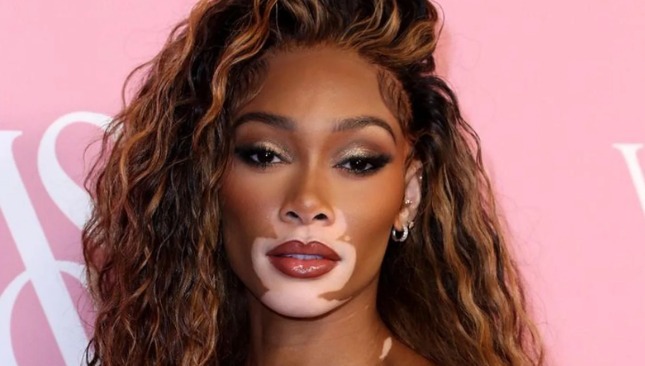 Concienciación y acción en el Día Mundial del Vitiligo