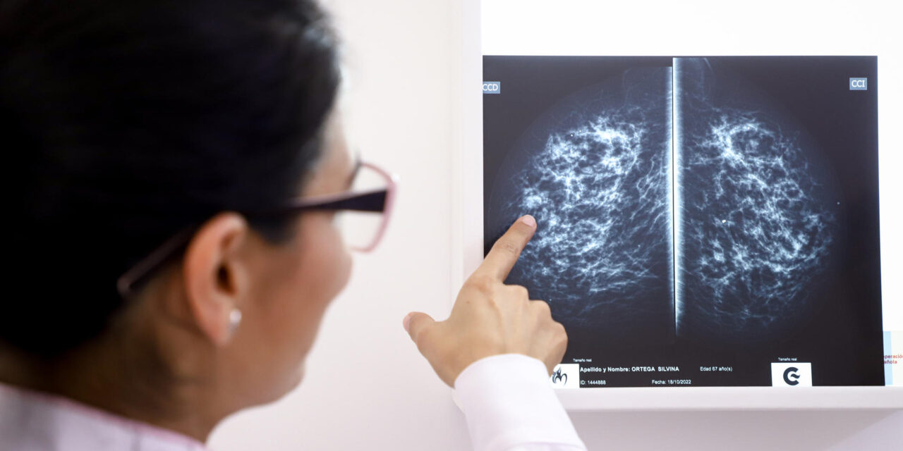 ¿Cómo seguir adelante tras vencer el cáncer?