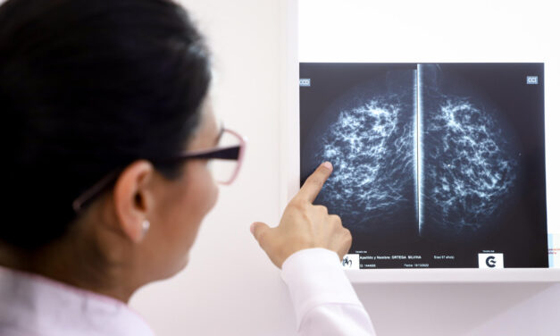 Reducen toxicidad en tratamientos oncológicos con medicamentos