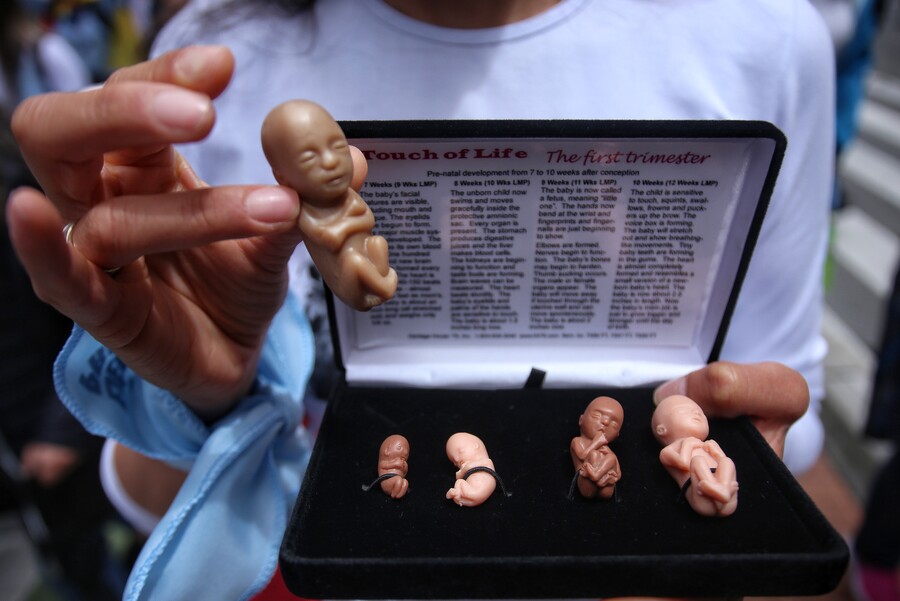 El laberinto legal y la opacidad del aborto en Colombia