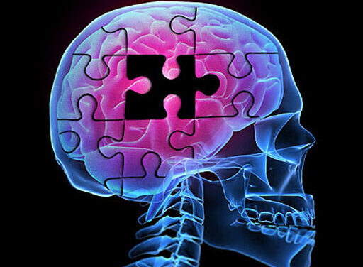 Aumentar actividad física podría proteger del Alzheimer