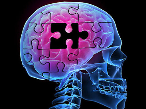 Aumentar actividad física podría proteger del Alzheimer