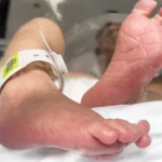 Menores mueren por desnutrición en Antioquia