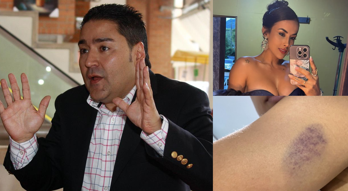 Misael Cadavid, testigo clave del juicio de Bomberos y Área Metropolitana, tiene problemas psiquiátricos, es mitómano, se automedica, y además maltratador de mujeres: así lo revela su expareja